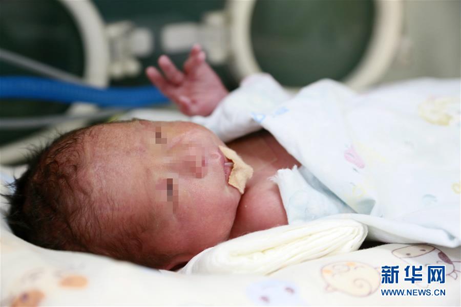 （图文互动）（3）中国首个移植子宫内孕育宝宝在西京医院出生