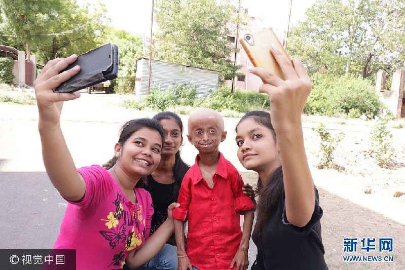 2017年9月11日（具体拍摄时间不详），印度中央邦，来自印度中央邦的11岁男孩Shreyash Barmate外表看起来就像是个老人，这是因为他患有早衰症，衰老速度是同龄人的8倍。虽然只有11岁，Shreyash已经长了皱纹，并且还出现了秃发，四肢也比同龄人要脆弱。尽管很有可能在2年后死去，Shreyash并没有放弃对未来的希望，他唱歌，弹奏乐器，骑自行车，开汽车，也会去游泳。他说自己长大后想成为一名歌手。***_****** EXCLUSIVE *** MADHYA PRADESH, INDIA - SEPTEMBER 2017: Shreyash Barmate, 11, who suffers from Progeria, poses for a picture with his family and friends at his home on September, 2017 in Madhya Pradesh, India. An inspirational boy with an ultra-rare genetic condition that makes him look like an old man refuses to let it hold him back ? and even drives a car. Shreyash Barmate, 11 who lives in Madhya Pradesh, India, has progeria ? a condition which causes rapid aging in children. The condition leaves Shreyash suffering from baldness, heavy wrinkles and weakened limbs. The Progeria Research Foundation believe the syndrome is so rare it affects around 1 in 20 million people. PHOTOGRAPH BY Rare Shot / Barcroft Images London-T:+44 207 033 1031 E:hello@barcroftmedia.com - New York-T:+1 212 796 2458 E:hello@barcroftusa.com - New Delhi-T:+91 11 4053 2429 E:hello@barcroftindia.com www.barcroftimages.com PHOTOGRAPH BY Rare Shot / Barcroft Images