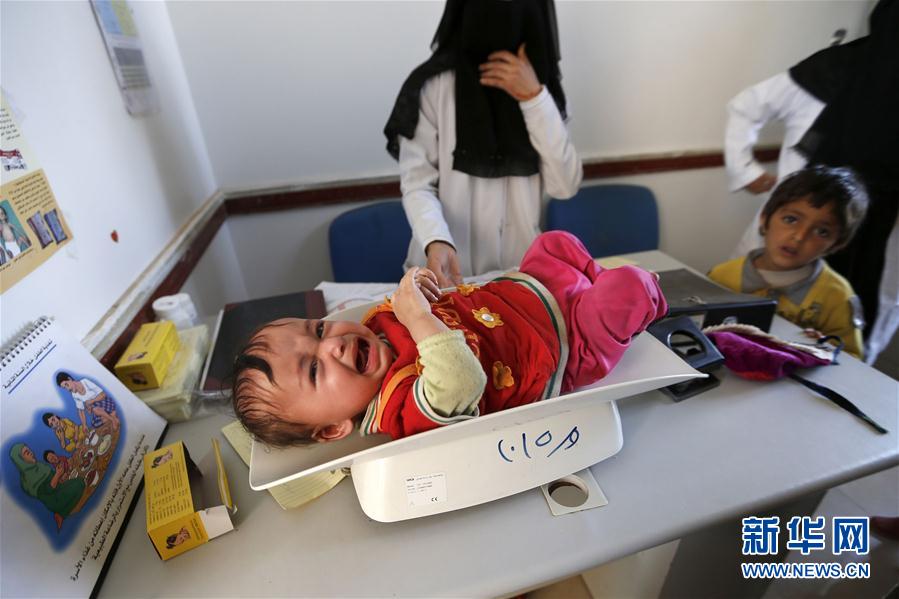 （外代一线）（7）也门：将近220万儿童营养不良