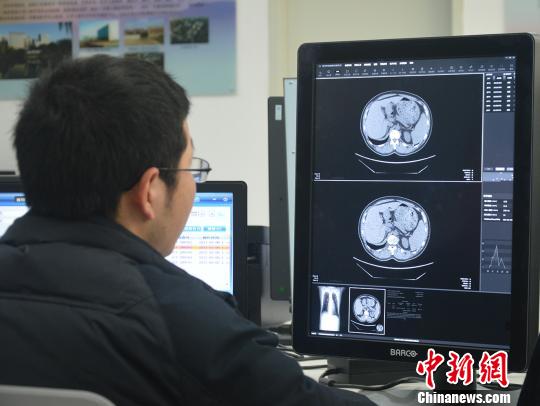 安徽推出肺癌识别机器人已用于临床试验