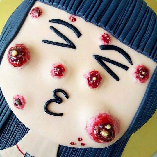 国外蛋糕师创造挤痘痘蛋糕 网友大呼:恶俗