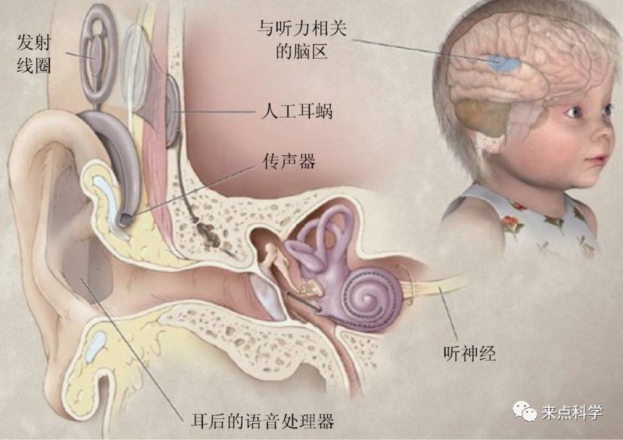 立忠表示,有关"控脑"的应用目前还比较少,最成功的不过是人工耳蜗应用