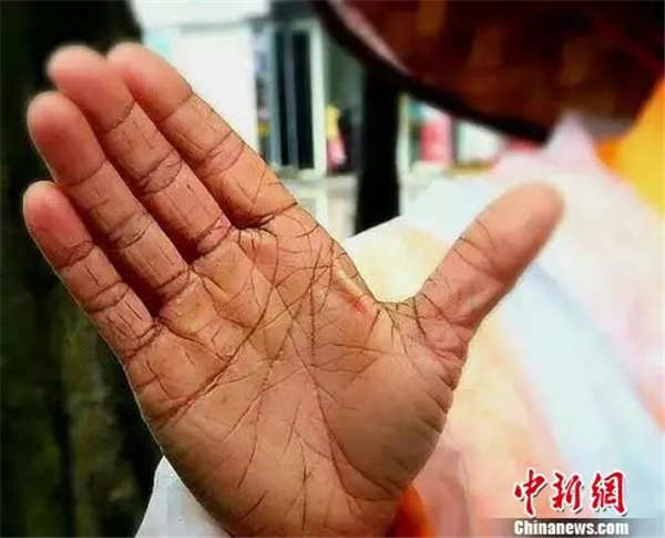 不存在的   15   这是一位环卫工的手   粗糙,僵硬