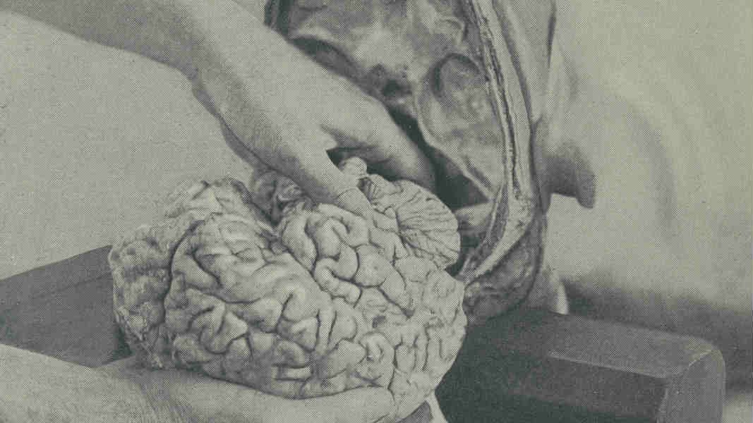 如果你的死因恰好让医生或者家人觉得需要授权尸检,那么这个过程绝不