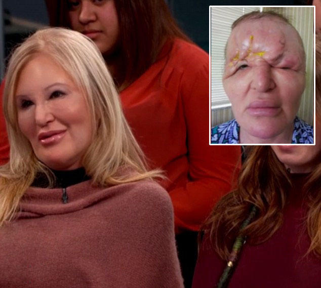 分校的医生热扎(reza jarrahy)成功帮助布莱恩进行了第3次修复手术,使