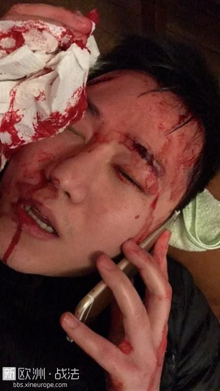 中国公民遭法国警察射杀 华人祈福被打满脸是血